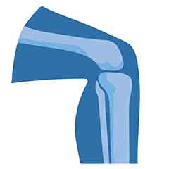 Здоровье суставов и костей