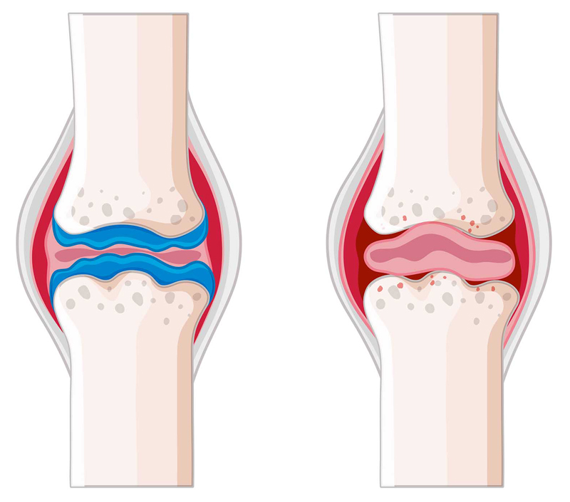 Способствует здоровью костей и сердечно-сосудистых заболеваний
